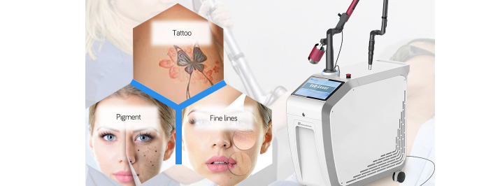The role of fluence in laser tattoo removal machine