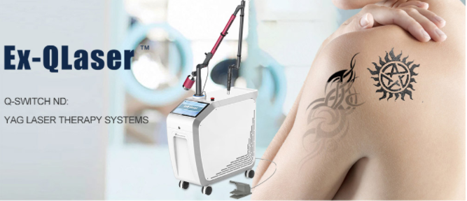 Questions to ask before buying Q switched ND YAG laser machine