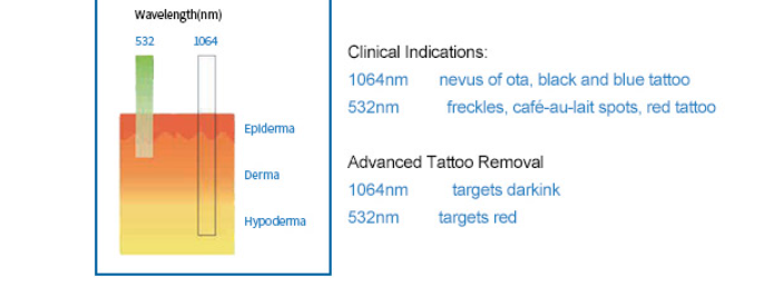 Why are some tattoos stubborn and how to remove them with a tattoo removal device
