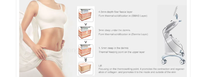 What is the difference between hifu machine thermage and 7D hifu skin rejuvenation machine