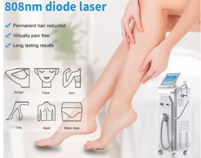What are the commonly used laser hair removal equipment