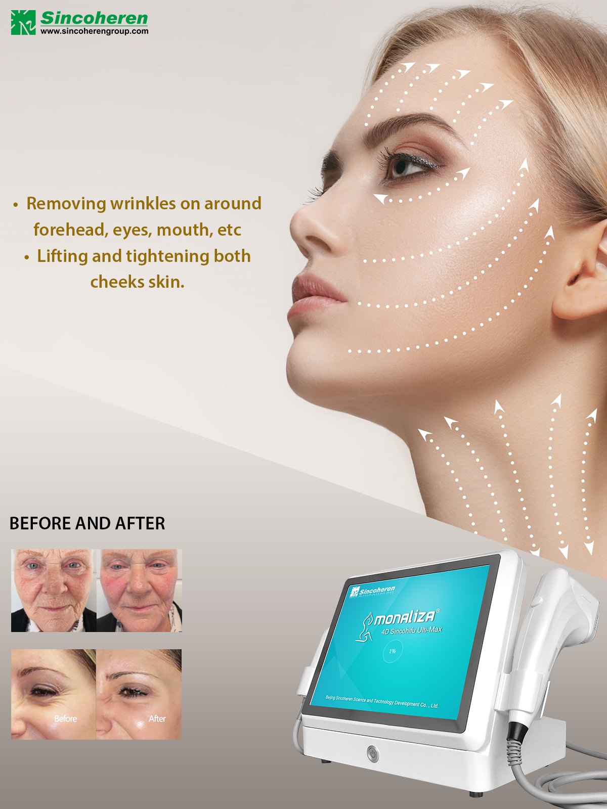 Monalisa 2 in 1 hifu machine 4 5d for face lifting wrinkle removal and slimming