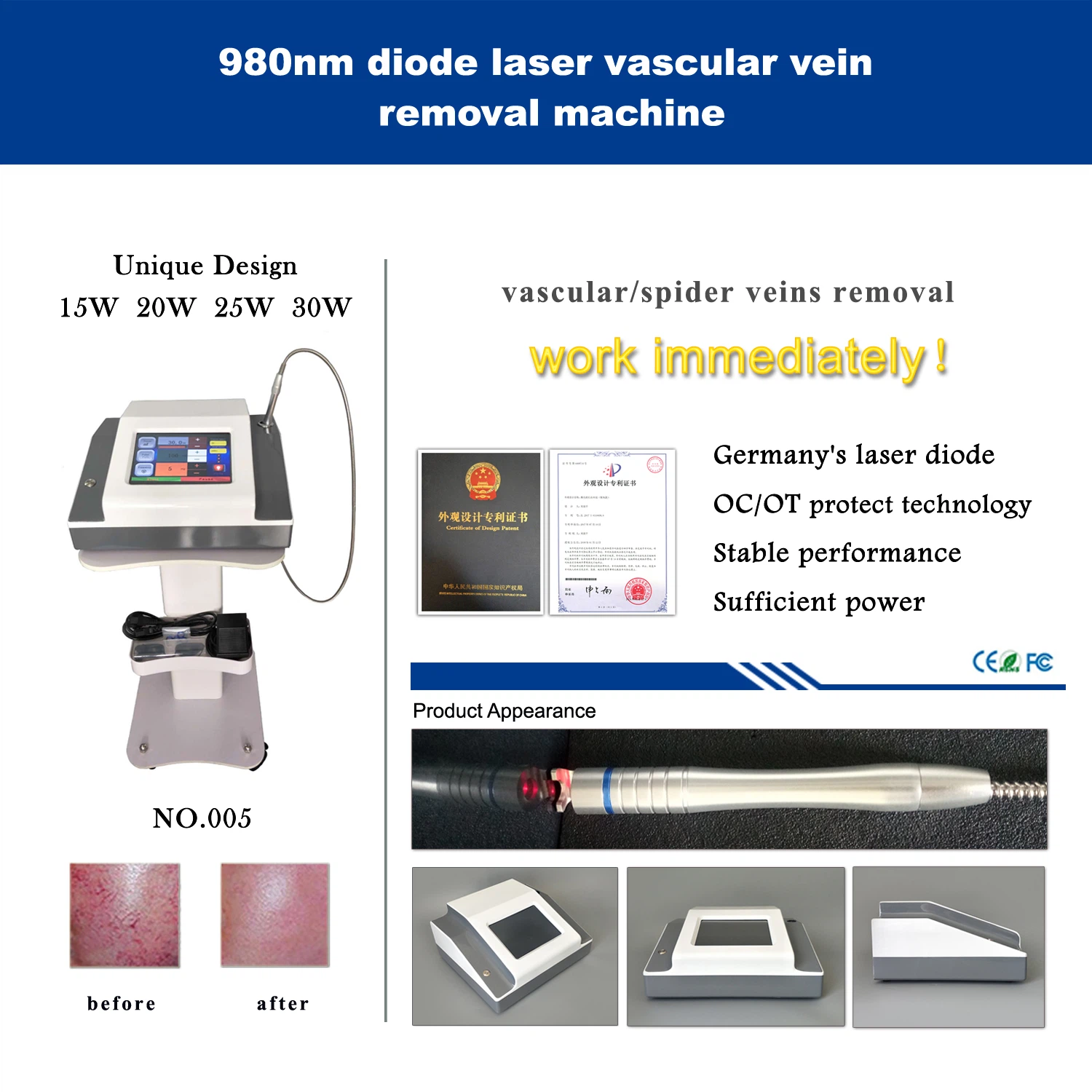 Portable Vascular Vein Removal 980nm Machine