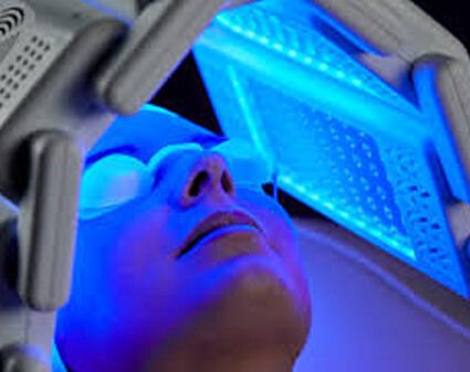 PDT LED light therapy