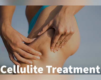 RF Cellulite Treatments & Skin Tightening Treatments